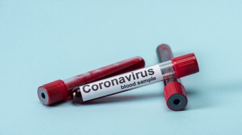 Еще 15 случаев заражения коронавирусом выявили в нескольких регионах